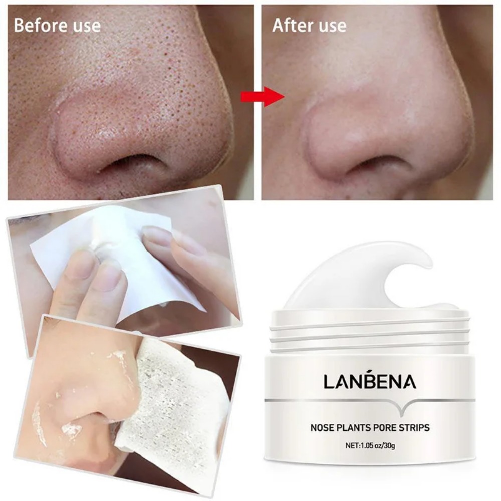 Nase Mitesser Entferner Creme  – Black Face Mask Pack Bewertung und Preis